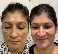 Pearl Bright Lighting and Whitening Face Cream by Shanika&rsquo;s Touch of Beauty