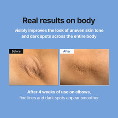 MEDITHERAPY Retinal Skin Booster Serum 5.07 Fl Oz | Retinaldehyde, Niacinamide,