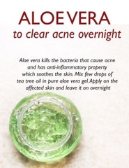 Aloe Vera Gel (THICK) 100% Pure Organic Soothing Moisturizing Skin Lotion – 4oz