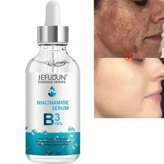 Niacinamide 10% Facial Serum Skin Brightening Dark Spots Eraser, 30ml [USA Stock