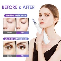 Mini Electric Nano Water Gun And Replacement Pins/Tube Anti-aging Facial Machine