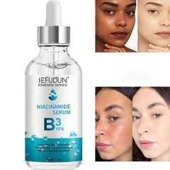 Niacinamide 10% Facial Serum Skin Brightening Dark Spots Eraser, 30ml [USA Stock