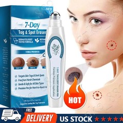 Tag & Spot Eraser Mole Skin Tags Removal Tool Eraser Pen Painless Long-Lasting🔥