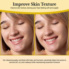 turmeric kojic acid cleansing pads