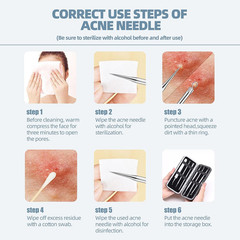 Professional Blackhead Remover and Comedone Extractor Tool Kit