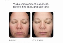 NEW PCA Skin Triple Exfoliation Peel Pads 30 Count + Hydrating Toner Bundle