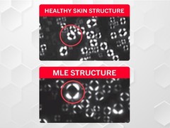 ATOPALM Intensive Moisturizing Cream for Dry & Sensitive Skin, Face Moisturizer,