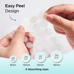 Tea Tree & Calendula Oil Hydrocolloid Acne Stickers – 180 Count for Clear Skin