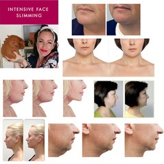 Face Slimming Double Chin Reducing Strap V Line Lifting Sagging Eliminates Belt