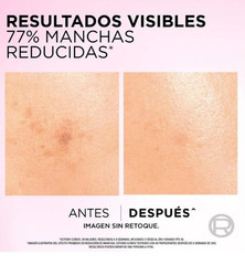 Sérum facial L&rsquo;Oréal Paris Glycolic Bright antimanchas ácido glicólico, niacinam