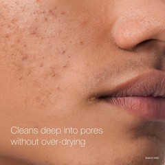 Rapid Clear Maximum Strength Acne Face Pads, for Acne Prone Skin, Salicylic Acid