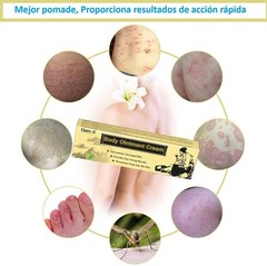 Crema para Dermatitis, Eccema, Psoriasis, Picor y Erupciones by Cherioll