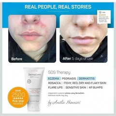 Clinically Tested DermaCalm SOS Therapy by Amelie Monnier