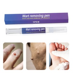 12 Hours Wart Remover Pen Eliminate Foot Corn Warts Skin Tag Remover Woman Man