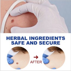 12 Hours Wart Remover Pen Eliminate Foot Corn Warts Skin Tag Remover Woman Man