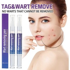 2x Removal Pen Eliminate Wart Liquid Hand Foot Warts Remove Flat Warts Condyloma