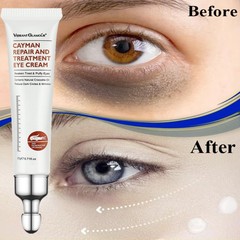 2PCS Instant Remove Dark Circles Wrinkles Face Lines Puffy Eyes Under Eye Cream