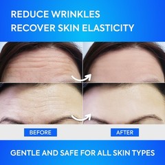 SILKDERMIS Forehead Wrinkle Patches 12Pcs with Aloe, Collagen, Vitamin E