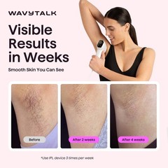 IPL Hair Removal Device 24J Dual Pulse Ice Cooling Corded White Wavytalk Bare
