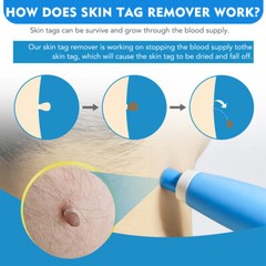 2-8 mm Micro Auto TagBand Skin Tag Remover Device for Small to Medium Skin Tags