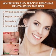 Herbal Spots Peel-Off Facial Mask for Deep Cleansing Acne Skin Whitening 100ml