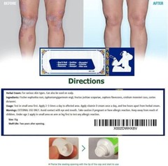 SKIN OINTMENT BODY PSORIASIS DERMATITIS ECZEMA NATURAL TREATMENT CREAM 15G