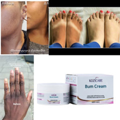 Dark Skin Bum Cream Bleaching Cream Whitening Lightening 50 g