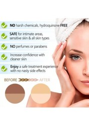 KOJIC ACID Skin Whitening Lightening Brightening Serum Bleaching/Spot Fade Cream