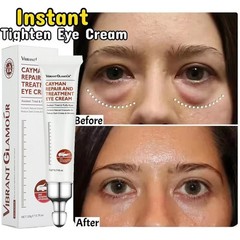 2PCS Instant Remove Dark Circles Wrinkles Face Lines Puffy Eyes Under Eye Cream