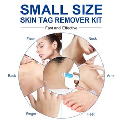 Skin Tag Removal Tool Kit Rubber Bands Home Use Wart Acne Micro Skintag Remover