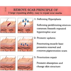 YOXIER Lavender Scar Repair Cream Anti Stretch Repair Marks Scar Removal Cream