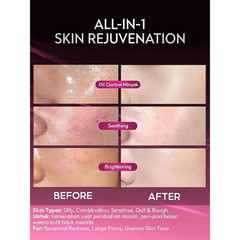 Cyeecare Peeling Solution Serum AHA Face Exfoliator Dark Spot Acne Marks Care