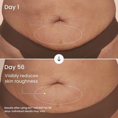 GET-DREAMY Overnight Toning Whip – Cellulite Cream & Skin Tightening Support …