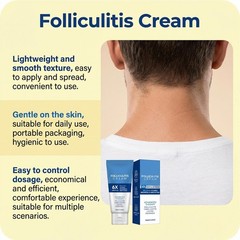 Folliculitis Treatment Cream: Effective Treatment for Folliculitis Scalp