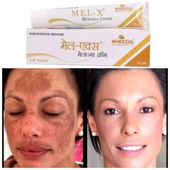 Wheezal Mel-X Melasma Cream (25g) Homeopathic Pigmentation Solution