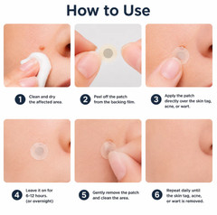 Curalona Microneedle Patches 144pcs, Skin Tag Wart Acne Remover Patches