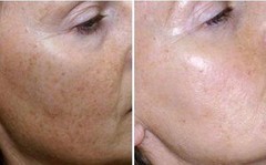 32 OZ. FINE LINE SMOOTHER HYALURONIC ACID SERUM WITH COPPER PEPTIDE & B5