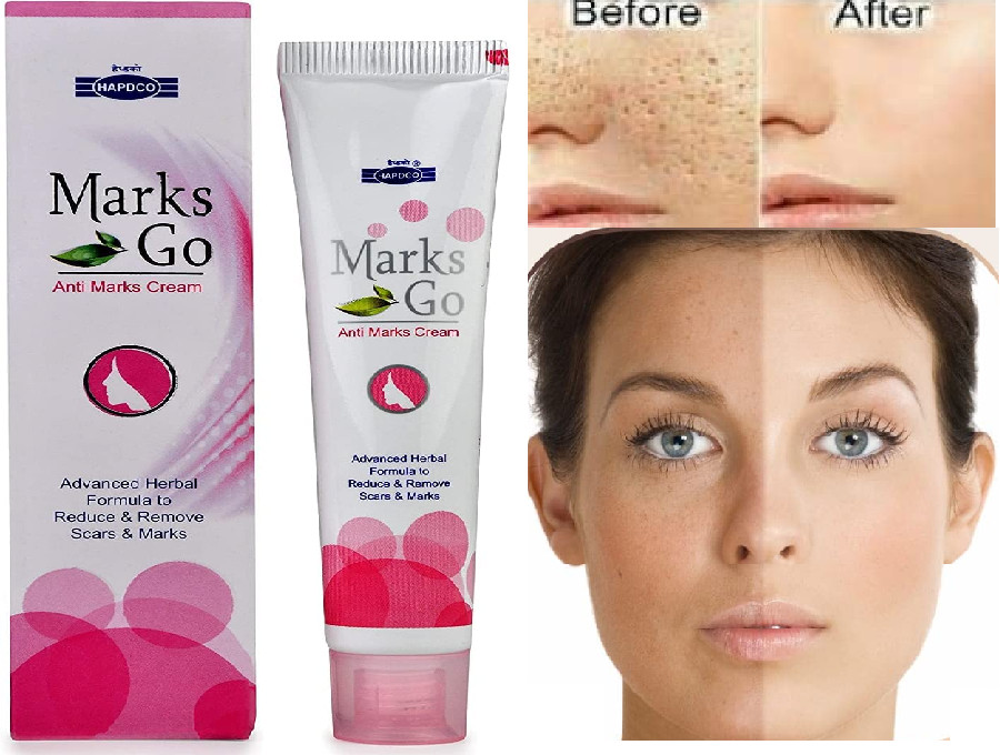 Hapdco Marks Go Cream Remove Blemishes, Dark Circle Advance Natural Formula 25gm