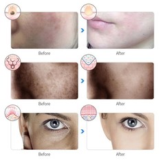 7 Colors LED Facial Mask Light Therapy Face Neck Skin Rejuvenation Beauty Tool