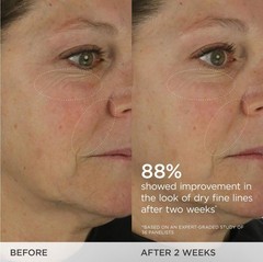 The Dewy Skin Cream | Rich Face Cream to Hydrate, Plump and Protect Dry and C…