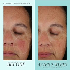 ✨ Kate Somerville HydraKate Recharging Serum | New in box | Full Size ✨MFR 2025