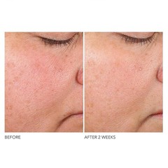 Dr. Dennis Gross Advanced Retinol + 1 Ounce (Pack of 1), and Ferulic