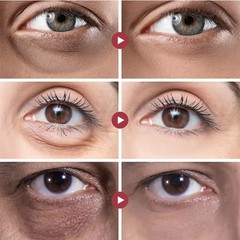 2PCS Instant Remove Dark Circles Wrinkles Face Lines Puffy Eyes Under Eye Cream