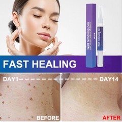 5Pack 12 Hours Wart Remover Pen Skin Tag Mole Remover Eliminate Foot Corn Warts