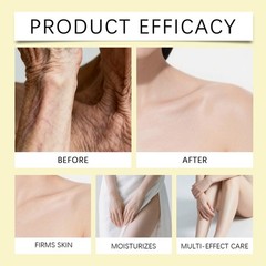 Quality Amatemas Peach Mami Firming Body Cream – Hydrating Saggy Skin Tightening