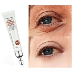 1Pc Eye Cream Remove Eyes Bags Dark Circles Anti Aging Eye Cream Lift Firm Serum