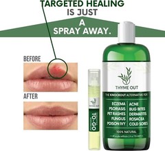 Thyme Out plus Eczema Treatment Psoriasis Treatment Treats Acne Dermatitis Skin