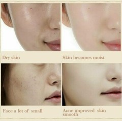 ANJO Premium Snail Cream Repair 50ml, Whitening buy 5 get 1 free