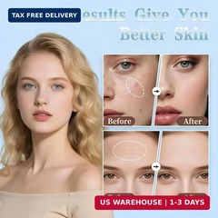 Titanium Derma Roller Stamp – 140 Microneedle Beauty Skin Care Tool – Derma Roll