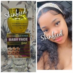 baby face facial cream Active Clear Dark Spots $ Scars In 7 Days (Gold)